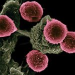 Why Young And Female Patients Don’t Respond As Well To Cancer Immunotherapy