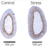 Stress on Every Cell: Mapping the Stress Axis in Detail