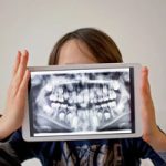 Study Shows Dental Developmental Anomalies Differ in Pediatric Cancer Patients